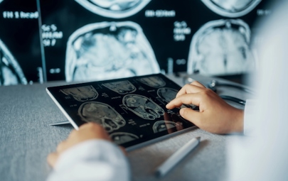 healthcare professional looking at patient's scan healthcare professional looking at patient's scan