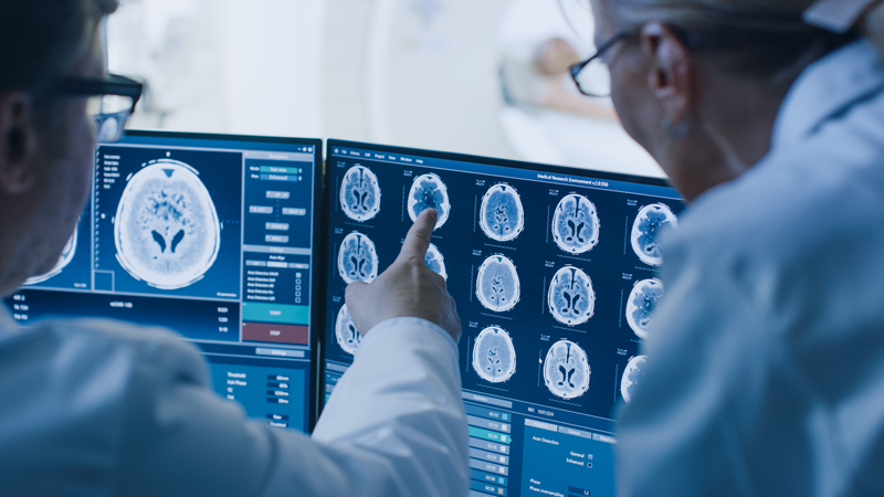 two CT technologists reading a CT brain scan on a monitor two CT technologists reading a CT brain scan on a monitor