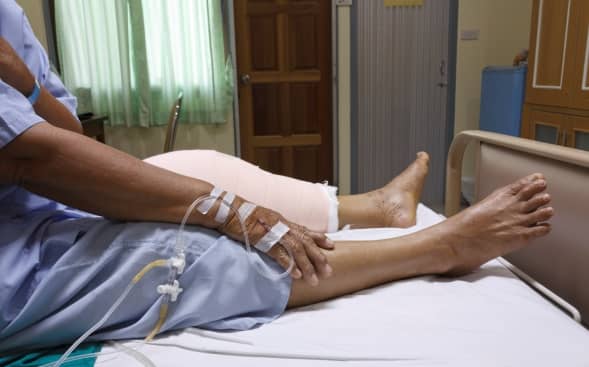 Patient who has just undergone knee replacement Patient who has just undergone knee replacement